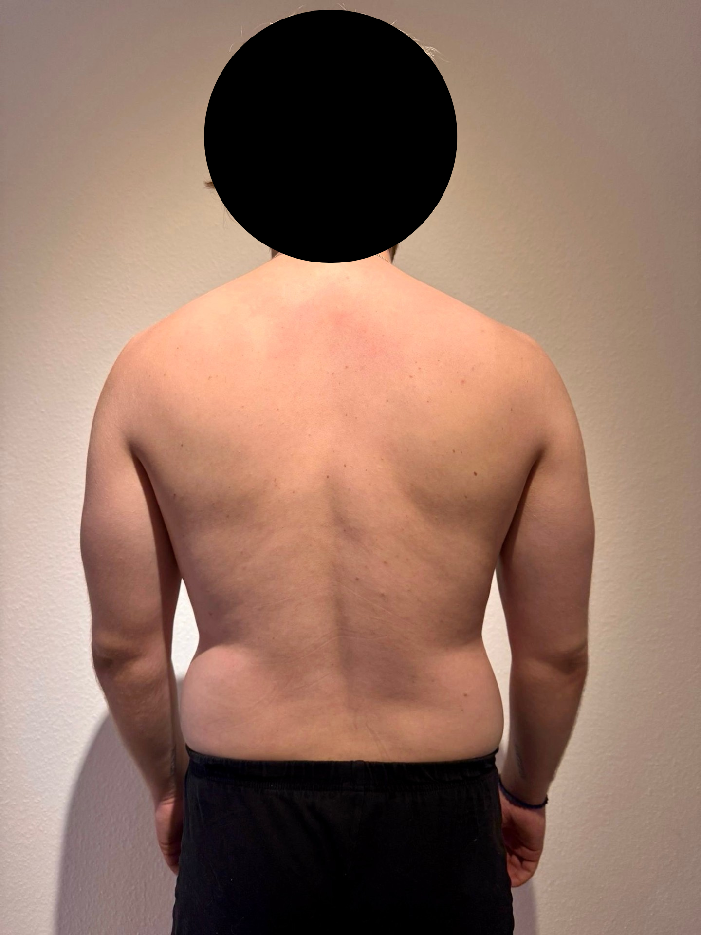 Vorher Transformation