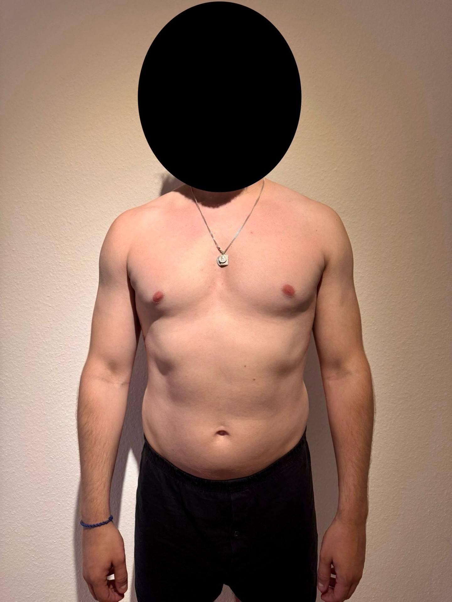 Vorher Transformation