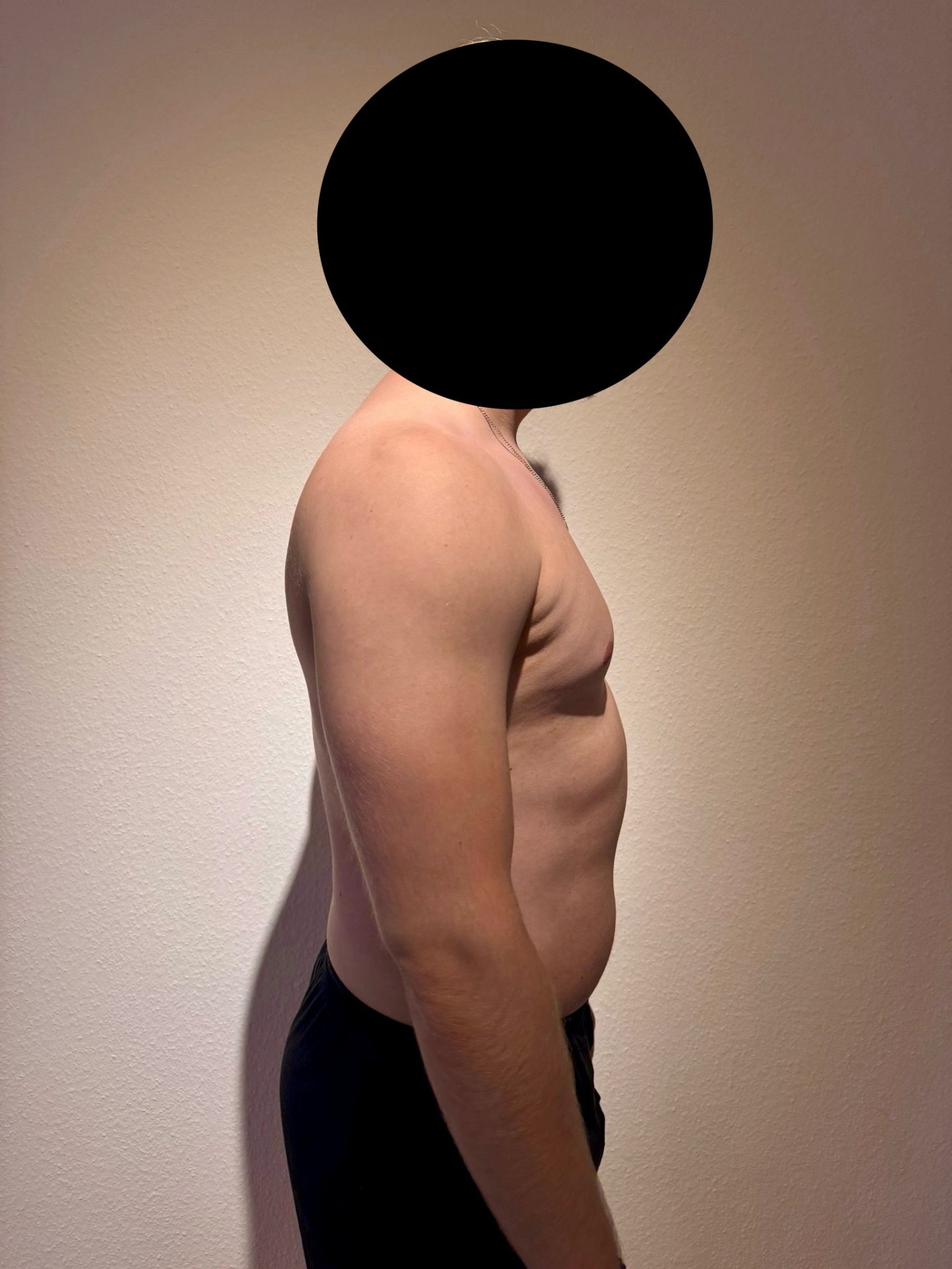 Vorher Transformation